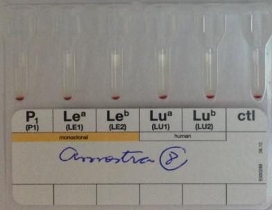 46 Os 9 animais foram negativos, de forma concordante e completa, para todos os antígenos eritrocitários dos sistemas Lewis (antígenos Le a e Le b ), P (antígeno P 1