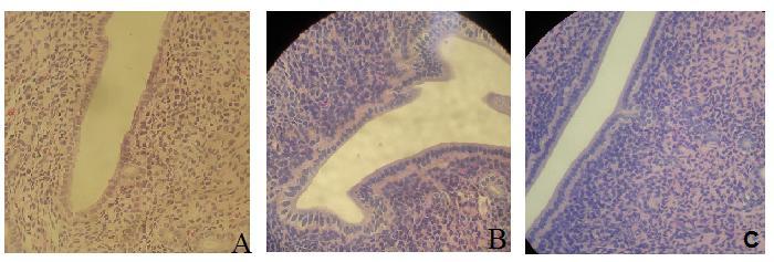 Figura 1: Fotomicrografia do epitélio superficial (400x). A grupo controle; B grupo E; C grupo E+P Figura 2: Fotomicrografias do estroma endometrial (40x). A grupo controle; B grupo E; C grupo E+P. Figura 3: Fotomicrografia de glândulas no estroma endometrial (100x).