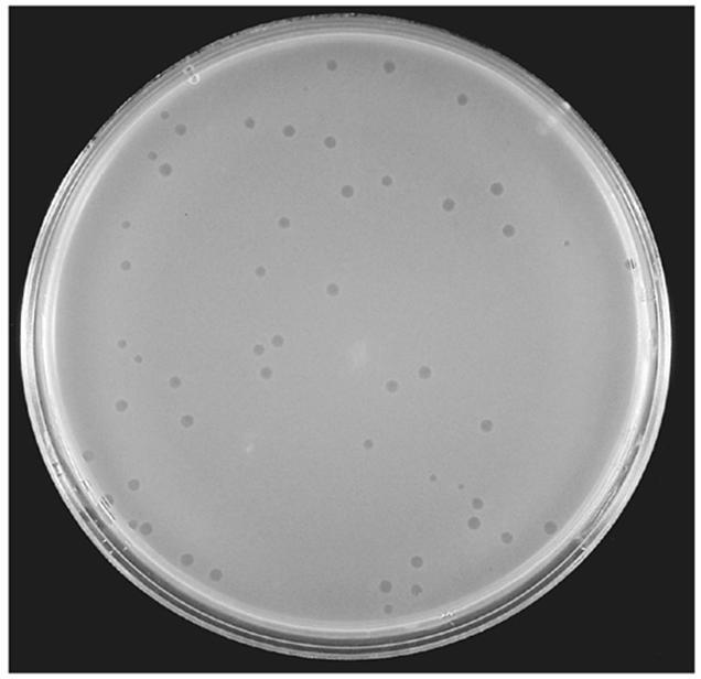 Cultivo de bacteriófagos Quantificacão de vírus bacterianos utilizando o