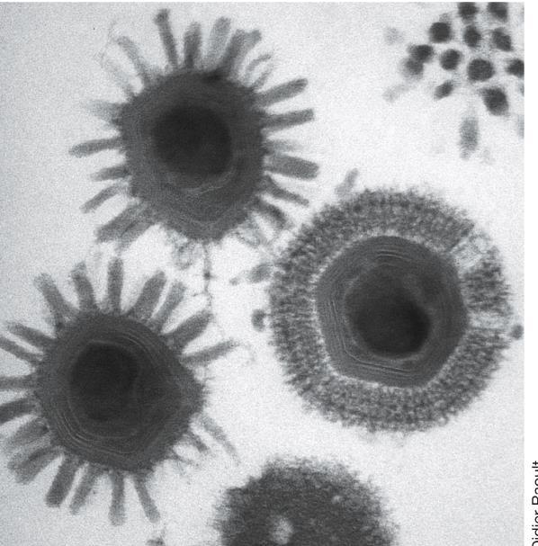 MET de Mimivirus, um vírus gigante.