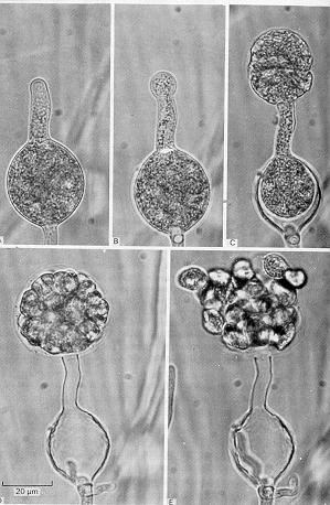 Família Pythiaceae Apresenta espécies parasitas facultativas e saprófitas obrigadas, com micélio bem desenvolvido, intracelular ou intercelular. Haustórios podem estar ocasionalmente presentes.