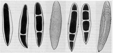 Exserohilum Formação de septos nos conídios Setosphaeria teliomorfa de Exserohilum Fungos Mitospóricos Características Gerais Trata-se de um grande agrupamento heterogêneo de fungos sapróbios,