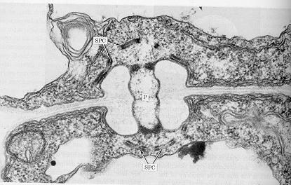 Corte de hifa de basidiomiceto, visto em microscópio eletrônico de transmissão mostrando um septo dolipórico e a tampa do poro em cada lado Etapas na formação de um grampo de conexão simultaneamente