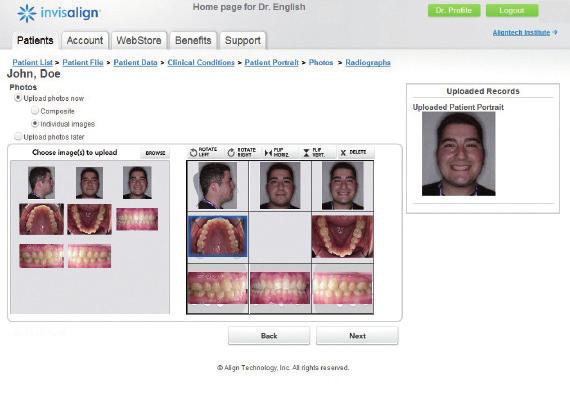 Caixa de Envio Invisalign Checklist.