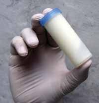 2 - O conservante para a análise de CBT deve ser adicionado ao leite conforme recomendação do