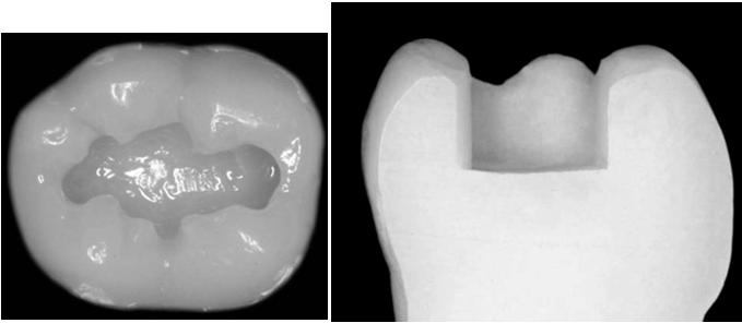 Caixa Seqüência oclusal operatória Fator