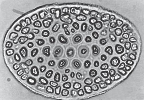tetrasporangia (arrow). do talo, região cortical com 2 camadas de células pequenas, de formato irregular; em vista superficial, células dispostas irregularmente, medindo 2-5 x 4-5 µm.