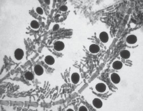 Crouanophycus latiaxis: 15) detalhe da ramificação verticilada no talo; 16) ramificação do