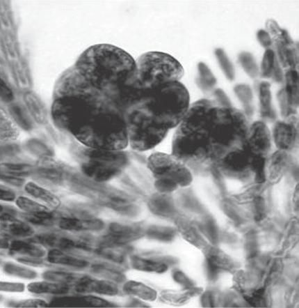 96 Nunes, J.M.C. & Guimarães, S.M.P.B. 20 µm 5 µm 50 µm Figuras 21-23. Crouanophycus latiaxis: 21) detalhe do gonimolobo; 22) detalhe do ramo espermatangial; e 23) arranjo do ramo espermatangial.
