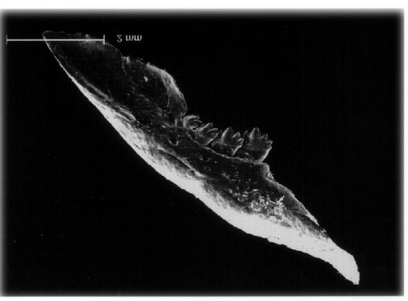 120 Figura 1. Imagem em Microscópico Eletrônico de Varredura do osso maxilar direito de Deuterodon iguape, rio Ribeira do Iguape, São Paulo, MCP 12175.