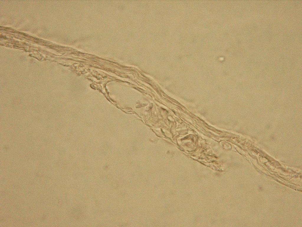 102 Esp c) 20 µm d) P G 20 µm Figura 2 - Cortes histológicos de robalo-peva C. parallelus com 150 DAE.