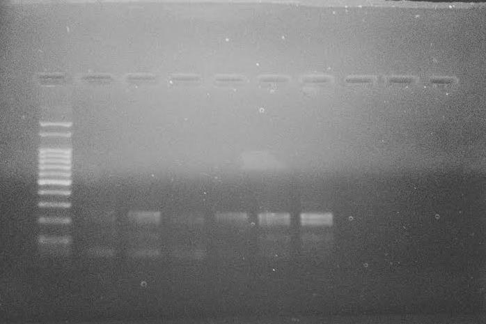 Os produtos amplificados dos DNAs extraídos pelo método de ULTRASSOM, também apareceram como bandas no gel de agarose, porém em uma amostra a banda estava bem fraca, em comparação com o método das