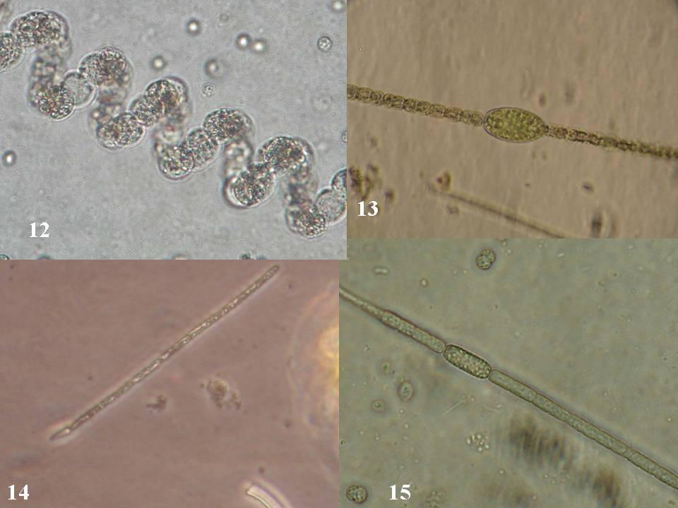 Fotos 12 a 15 - Cianobactérias que ocorrem no Estado de São Paulo.