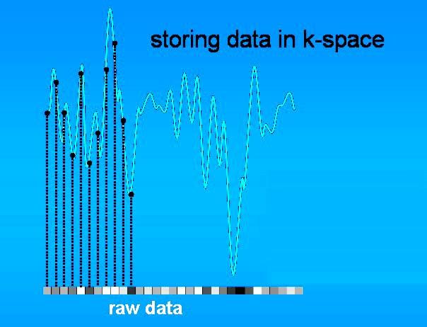 K-space É a matriz de