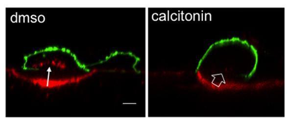 a calcitonina inibe a atividade do osteoclasto Verde: