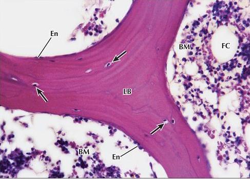 osteoclasto CT: tecido conjuntivo BV: vaso sanguíneo Trabécula com tecido