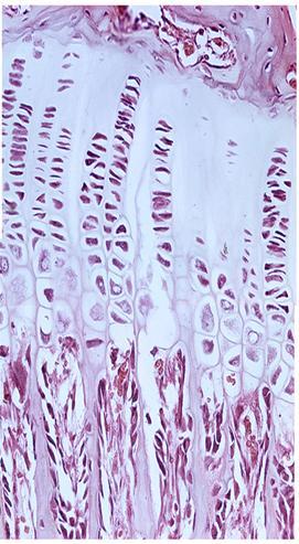 mitose, alinham-se em colunas verticais paralelas Zona de Maturação e hipertrofia dos crodócitos: Acúmulo de