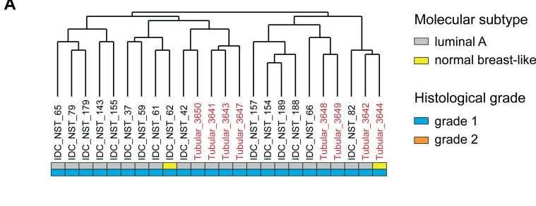 CA tubular vs CDI G1 pareados por subtipo molecular CA tubular Via do RE hiperexpressa INPP4B: gene supressor tumoral com atividade inibitória na via PI3K