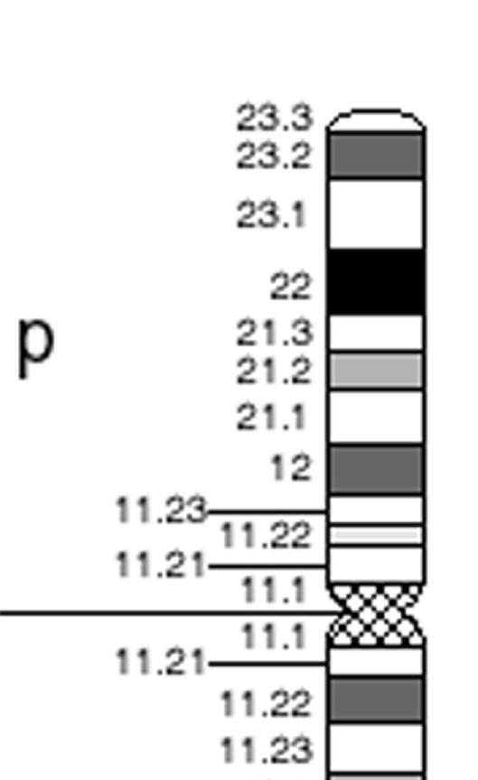 Integração de CGH e expressão gênica Gene Expression data SPFH domain protein 2 precursor -0.8361 PROSC 0.776691 G protein-coupled receptor 124-0.