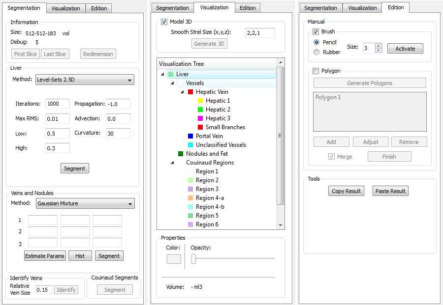 Capítulo 5. Avaliação Experimental 59 Figura 5.2: 3DLiver - Módulos de segmentação (a), visualização (b) e edição (c).
