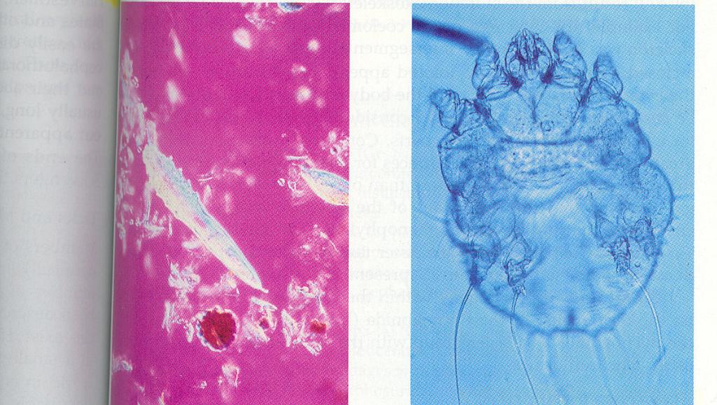 Filo Arthropoda Somente alguns artrópodes ultrapassam 60 cm de comprimento, a maioria encontra-se abaixo desse tamanho.