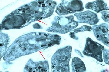 DERME CÉLULAS MATRIZ EXTRACELULAR SFA (substância amorfa) Água Glicosaminoglicanas (GAG