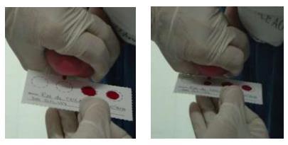 As doenças que integraram o PNTN naquele momento foram: fenilcetonúria, hipotireoidismo congênito, doença falciforme e outras hemoglobinopatias e