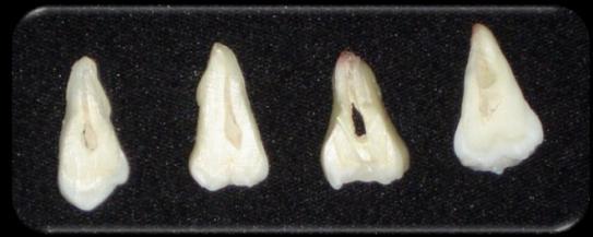 Foram obtidos cortes longitudinais, no sentido mésio-distal, na espessura de 1 mm, da região mais central de cada dente (Figura- 22).