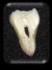 25), o corte do dente com a espessura correspondente a 1 mm (Figura-26) e uma