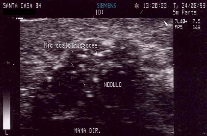 FIGURA 3: Caracterização ultra-sonográfica de uma