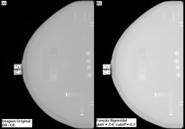 Capítulo 3. Materiais e Métodos 19 de imagens de um único phantom (CIRS-011A). Alguns dos resultados são apresentadas nas Figuras 3.4, 3.5 e 3.6. A Figura 3.