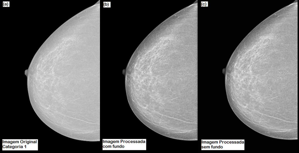 Capítulo 4. Resultados e Discussão 41 Figura 4.23: Exemplo da imagem de Categoria 1. (a) Imagem Original 1. (b) Imagem processada com fundo. (c) Imagem processada sem fundo. Tabela 4.