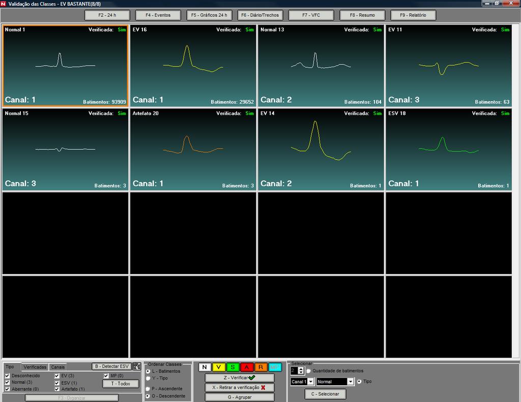 Holter Digital MAIS