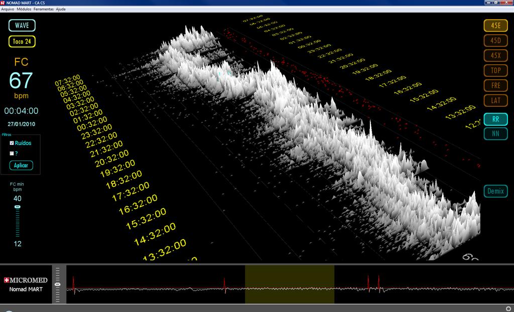 Holter Digital MAIS RECURSOS AVANÇADOS MART MAPEAMENTO DE