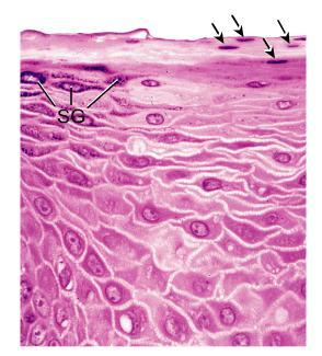 dermica EP: epitelio estratificado pavimentoso na mucosa oral o epitélio é estratificado e pavimentoso, mas