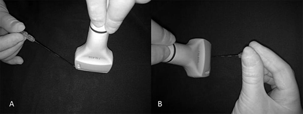 VISUALIZAÇÃO DA AGULHA Nos cortes transversais, é possível visualizar a agulha posicionado-a paralelamente ao transdutor (inplane) (Figura 3A) o que permite acompanhar a progressão da ponta e do