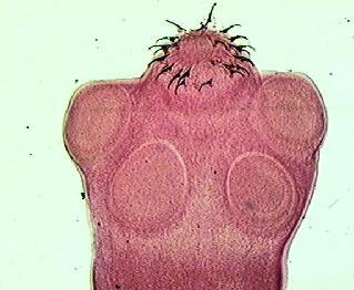 LAM Nº 56 Taenia solium (escólex) Coloração: Carmin Material de preparação: fezes