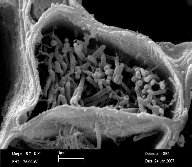 intercelulares XILEMA FLOEMA