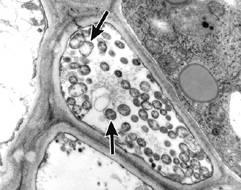 MOLICUTES Procariotos unicelulares, SEM parede celular, desprovidos de organelas