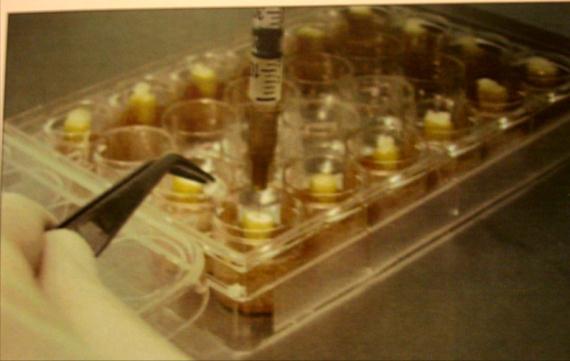 O meio de cultura (TSb) foi misturado com a suspensão bacteriana na proporção de 1:1 em volume e os canais radiculares foram contaminados, por meio de micropipetas, com 20 µl dessa mistura.