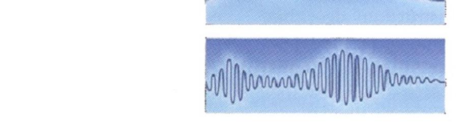 Os filtros utilizados em TC são filtros matemáticos utilizados pelo operador do equipamento ou médico radiologista. Existem diferentes tipos de filtros que podem ser utilizados.