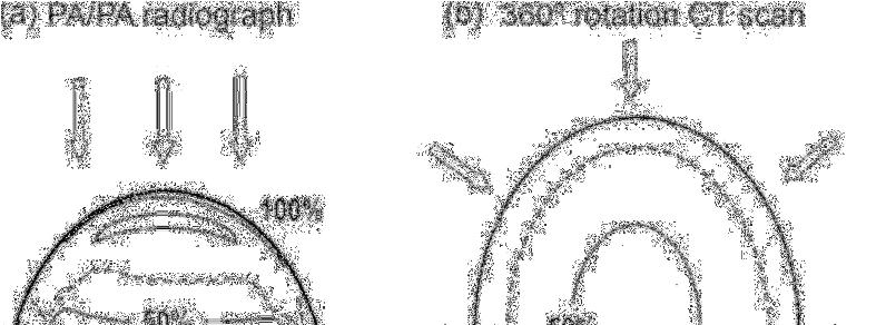 30 3.2 GRANDEZAS DOSIMÉTRICAS ESPECÍFICAS DE TC A tomografia computadorizada é uma modalidade de exame de imagem diferente das modalidades projecionais (fluoroscopia, mamografia, radiografia).