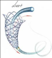 Verificar no rótulo ou embalagem do LEO PLUS o diâmetro máximo ou mínimo da artéria em função da dimensão nominal do stent.