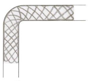 Figura 3 BOM BOM MAU: risco de posicionamento do stent perpendicularmente ao fluxo podendo provocar uma oclusão da artéria.