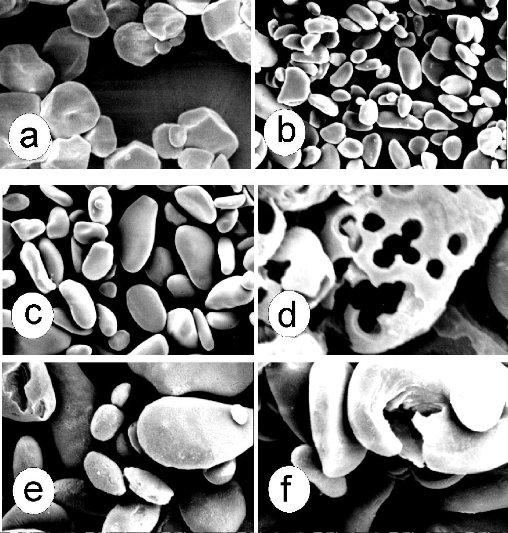 A corrosão dos grânulos de amido de bananas foi sobretudo superficial e eventualmente apical (Figuras 3 e 4) demonstrando a excepcional resistência dos amidos das duas espécies.