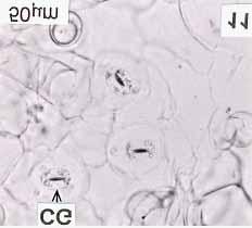 TT: tricoma tector; FV: feixe vascular. Figura 9. Malvariço (Plectranthus amboinicus (Lour.) Spreng.). Secção transversal de limbo: detalhe da nervura central.