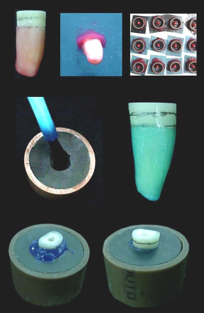 resina de poliestireno. Após a polimerização, os excessos foram removidos com lâmina de bisturi n 11 e as amostras armazenadas em água destilada.