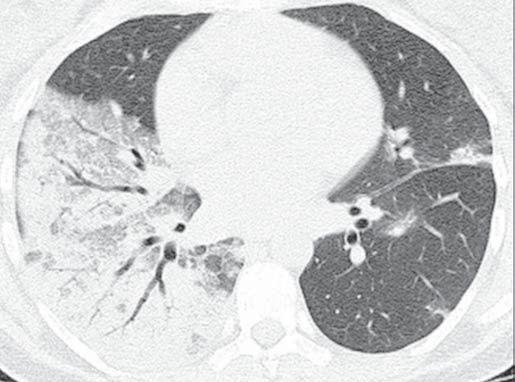 Verrastro CGY et al. Figura 4.