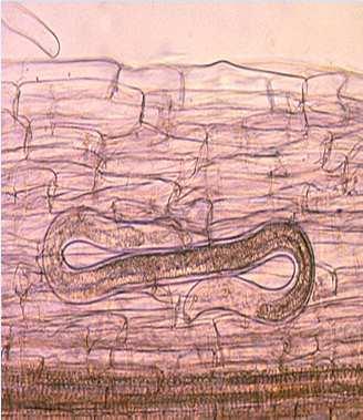 (Criconemoides, Paratylenchus) Migradores