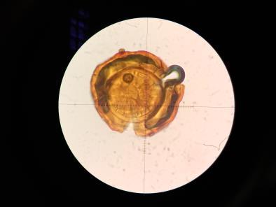 Fungos micorrízicos arbusculares Filo Glomeromycota; Apresentam arbúsculos,